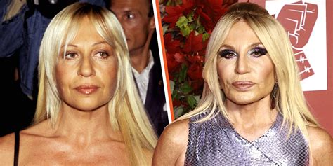 Donatella Versace Before & After: Facts about Her .